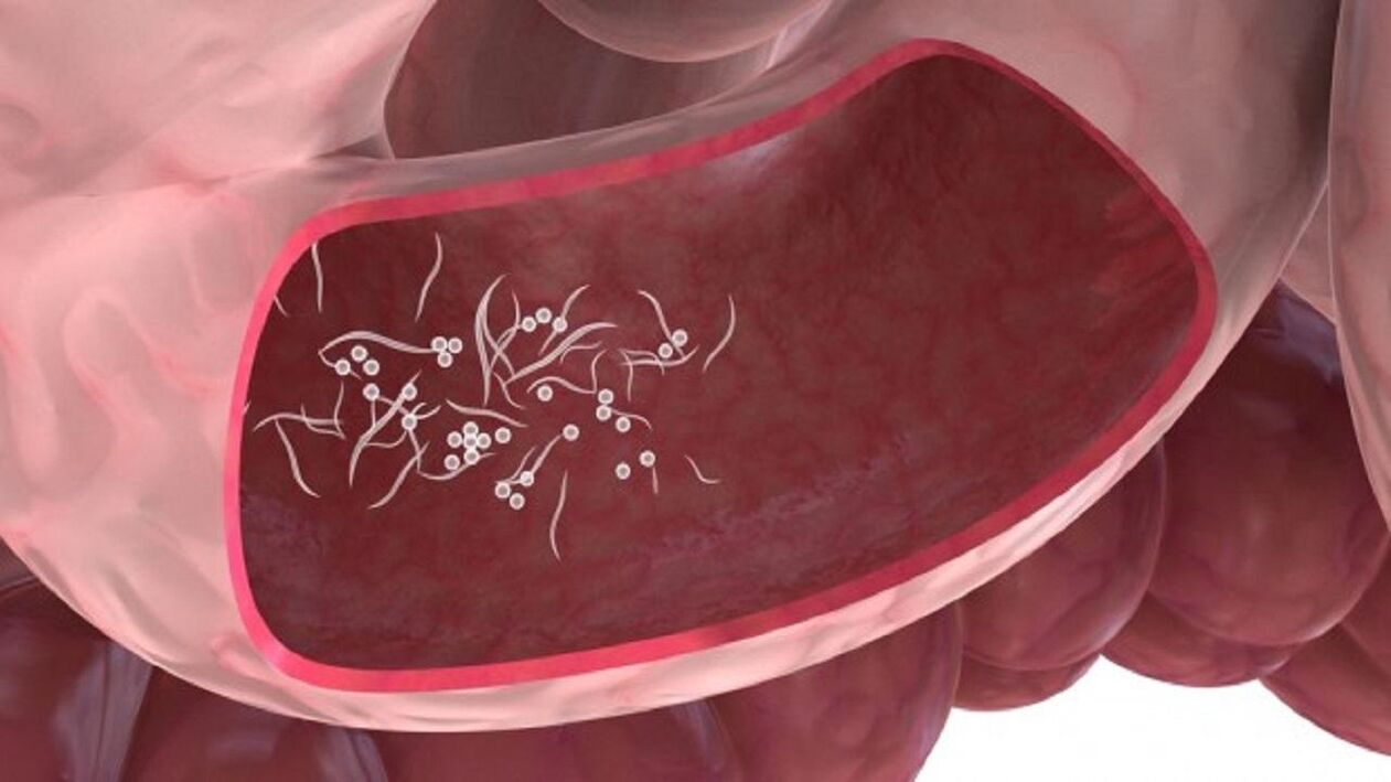 Giardia paraziti v jetrih