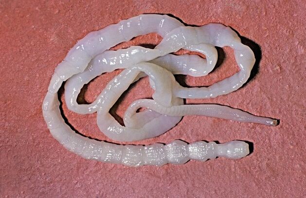 kako izgleda bikova trakulja