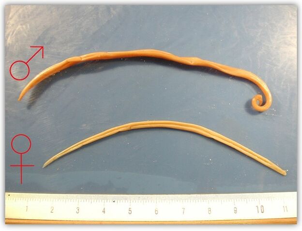 kako izgledajo okrogli črvi