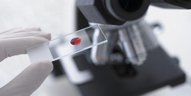 krvni test za odkrivanje parazitov v telesu